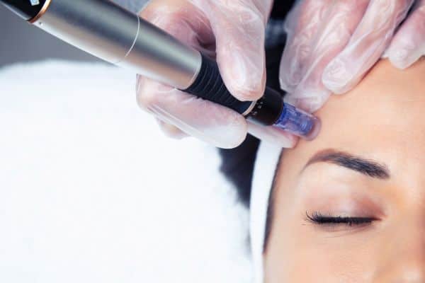 Explaining Total Skin Tightening Treatment and What to Expect 2 What Skin Concerns Can Total Skin Tightening Treatment Help With Wittering?
